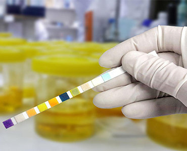 Prevent Urinary Infection